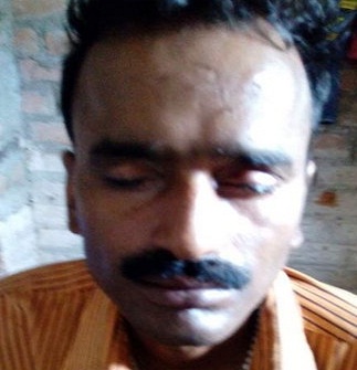 Wife  Husband  Crime  Madhya Pradesh  Rewa  India  Glue  Adhesive