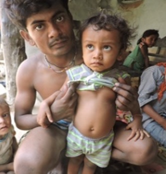 Breaking News: Measles kills five tribal children within a fortnight in Satna village