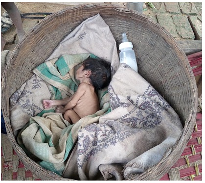 Madhya Pradesh  Child  Girl  Malnutrition  Shivpuri  India  Maternal deaths  Sex ratio  Infant mortality